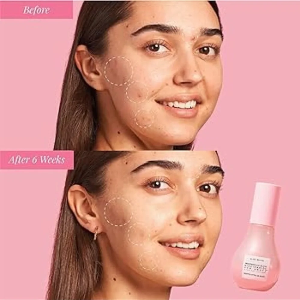 Glow Recipe Watermelon Glow Niacinamide Dew Drops Serum 40ml — NEW
